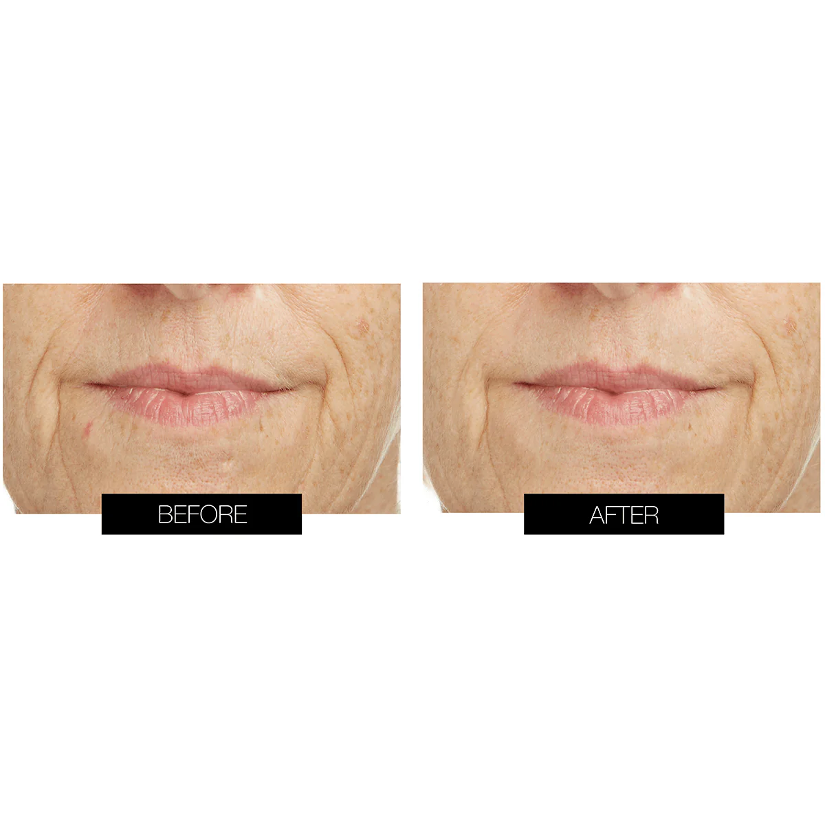 CurrentBody Skin LED Lip & Hydrogel Perfector Kit - Image 4